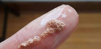 Bele grudvice u jajetu: šta to zaista znači i da li treba da brinete?