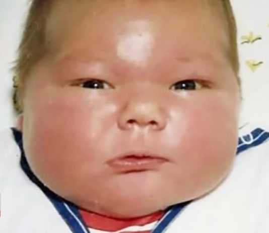 Sa preko 7 kilograma bio je najveća beba rođena te godine, čak i lekari bili šokirani prizorom: Nećete verovati kako danas izgleda ovaj gorostas
