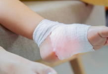 Dečak zadobio opekotine zbog popularnih patika: Imao je plikove, nije mogao da hoda – mama upozorila sve…Ako ih imate odmah bacite!!!