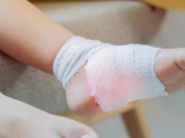 Dečak zadobio opekotine zbog popularnih patika: Imao je plikove, nije mogao da hoda – mama upozorila sve…Ako ih imate odmah bacite!!!