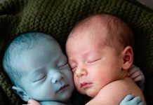 Kad je medicinska sestra stavila bebu bez života pored njene zdrave blizanke, samo je željela reći zbogom. Ali ono što se dogodilo nakon toga natjeralo ju je da padne na koljena u suzama…