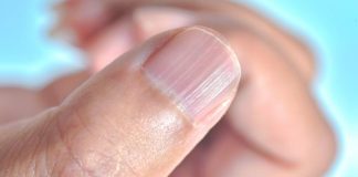 Ako imate ove linije na noktima nakon 40. godine, to je jasan znak da…