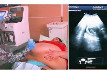 Trudna žena ima 226 kilograma i došla je na ultrazvuk, a onda je medicinska sestra podigla njen stomak i pogledala bolje… (VIDEO)