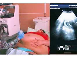 Trudna žena ima 226 kilograma i došla je na ultrazvuk, a onda je medicinska sestra podigla njen stomak i pogledala bolje… (VIDEO)