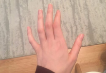 OBAVEZNO OBRATITE PAŽNJU: Ako vam trnu prsti, to može da znači nekoliko stvari, a ovo je uzrok