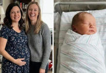 Nije je prihvatila zbog madeža — a istina je iznenadila sve