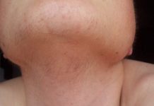 EVO ZAŠTO ŽENE IMAJU DLAKAVU BRADU! Ovo vam organizam govori!