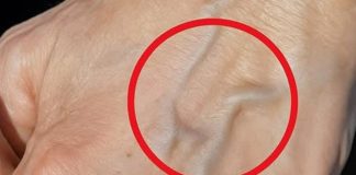 Ako imaš vidljive vene, to znači da si…😨😨‼️