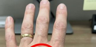 Ako imaš vidljive vene, to znači da si…😨😨‼️