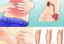 KAD SA BUBREZIMA NIJE SVE U REDU, TIJELO ŠALJE OVE SIGNALE: 6 Simptoma koje ne smijete ignorisati! KAD SA BUBREZIMA NIJE SVE U REDU, TIJELO ŠALJE OVE SIGNALE: 6 Simptoma koje ne smijete ignorisati! - featured image