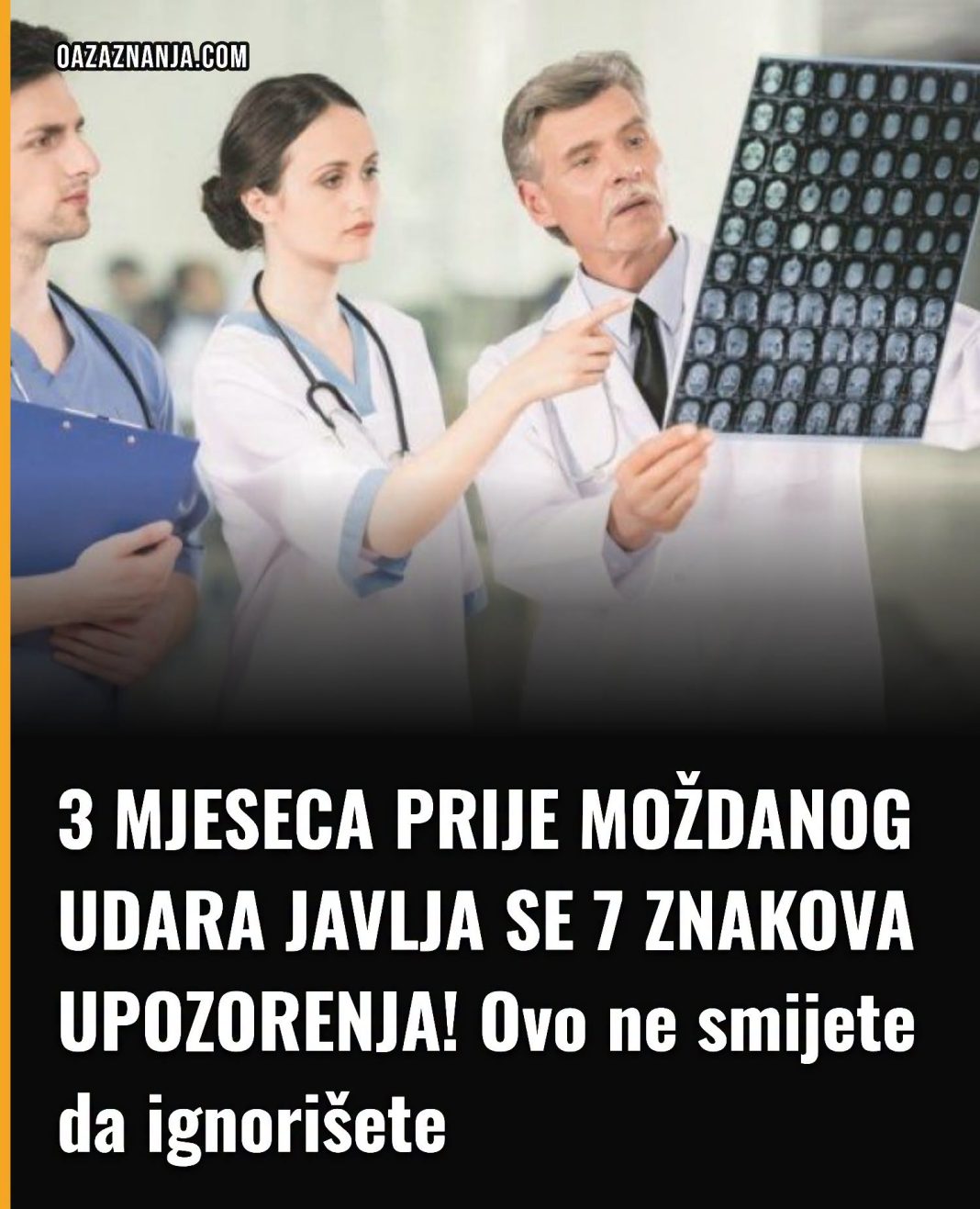 3 MJESECA PRIJE MOŽDANOG UDARA JAVLJA SE 7 ZNAKOVA UPOZORENJA! Ovo ne smijete da ignorišete - featured image