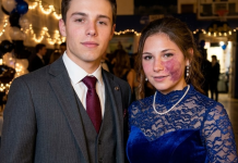 Najzgodniji momak u školi pozvao me je na maturantsko veče uprkos mom belegu na licu — i svi su se smejali, sve dok u salu nije ušla uprava škole.