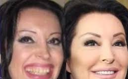POGLEDAJTE kako su izgledale domaće ličnosti PRIJE UMJETNIH ZUBA – CECA JE HIT (FOTO) POGLEDAJTE kako su izgledale domaće ličnosti PRIJE UMJETNIH ZUBA – CECA JE HIT (FOTO) - featured image