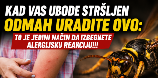 Kad vas ubode stršljen odmah uradite ovo: To je jedini način da izbegnete alergijsku reakciju!!!