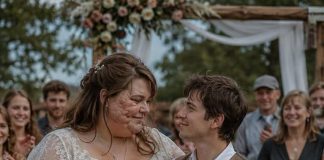 Otac je bez njezina pristanka udao kćer za siromašnog mladića koji je bio niži od nje jer je bio uvjeren da je nakon strašne nesreće nitko drugi više ne bi želio. Ali ono što se zatim dogodilo natjeralo je cijelu obitelj da požali zbog svojih riječi… 😲😨