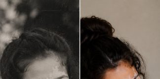 Moja svekrva rekla je da moj vitiligo „uništava obiteljsku lozu“ — a onda se rodila moja beba, i ono što je učinila izazvalo je posljednju reakciju mog supruga 💔😢