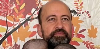 Sestre su se rodile sa jednom glavom za oboje, ali kada su imale 3 godine, lekari su ih razdvojili: evo kako izgledaju danas.