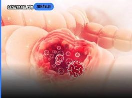 Rani simptomi raka debelog creva: 1 izgleda bezopasno, a baš njega većina ljudi svakog dana ignoriše Rani simptomi raka debelog creva: 1 izgleda bezopasno, a baš njega većina ljudi svakog dana ignoriše - featured image