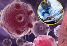 8 namirnica koje smanjuju upale i jačaju imunitet — savršen početak dana