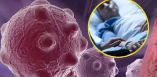 8 namirnica koje smanjuju upale i jačaju imunitet — savršen početak dana