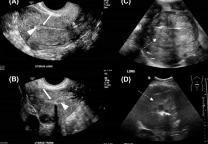 OD RAKA MATERICE UMIRE SVE VEĆI BROJ ŽENA: 6 jasnih signala da se u tijelu razvija ovaj opasan tumor! - featured image