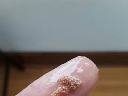 Bele grudvice u jajetu: šta to zaista znači i da li treba da brinete?