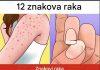 Simptomi koje ne treba ignorisati: Stručnjaci upozoravaju na moguće rane znakove ozbiljnih bolesti