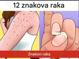 Simptomi koje ne treba ignorisati: Stručnjaci upozoravaju na moguće rane znakove ozbiljnih bolesti