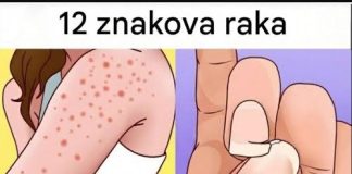 Simptomi koje ne treba ignorisati: Stručnjaci upozoravaju na moguće rane znakove ozbiljnih bolesti