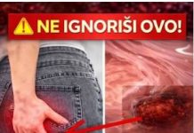 Rak debelog crijeva! UPOZORAVAJUĆI ZNAKOVI i SIMPTOMI koje NIKADA ne smijete IGNORIRATI.