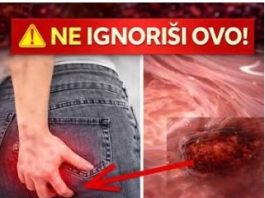 Rak debelog crijeva! UPOZORAVAJUĆI ZNAKOVI i SIMPTOMI koje NIKADA ne smijete IGNORIRATI.